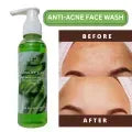 ANTI ACNE BUNDLE